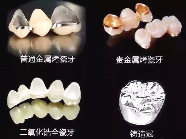 常德美奧口腔鉅惠看牙,韓國登騰種植牙3980元起,自鎖托槽矯正享5折優(yōu)惠！
