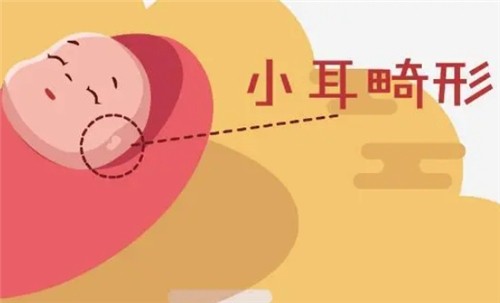 【河南中醫(yī)藥大學(xué)一附院】莊洪興教授暑假坐診，耳畸形修復(fù)限時(shí)預(yù)約！