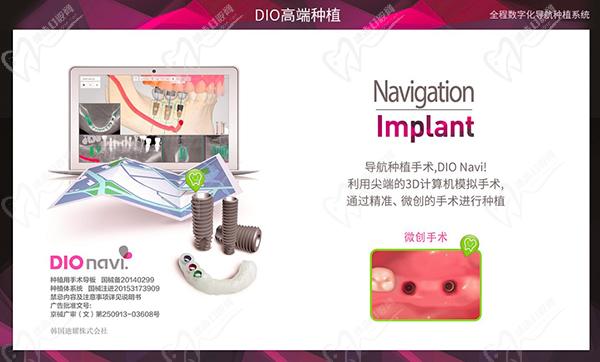 韓國(guó)DIO種植牙