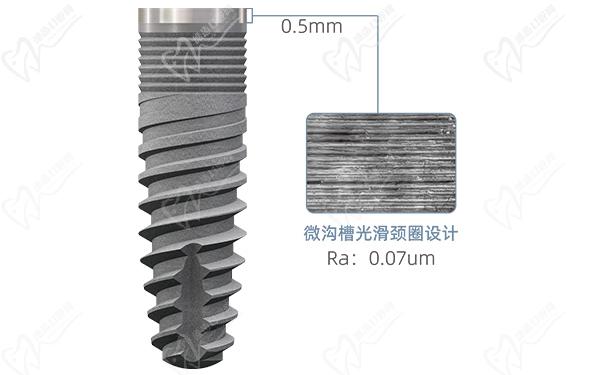 德國sky種植體使用壽命是幾年