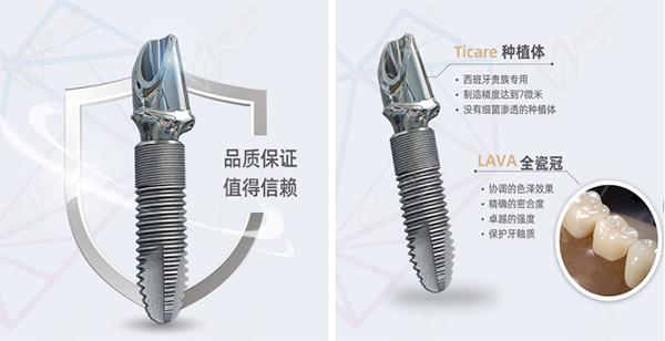 西班牙泰科種植牙怎么樣？
