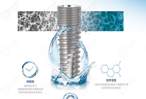 康盛種植牙質(zhì)量咋樣