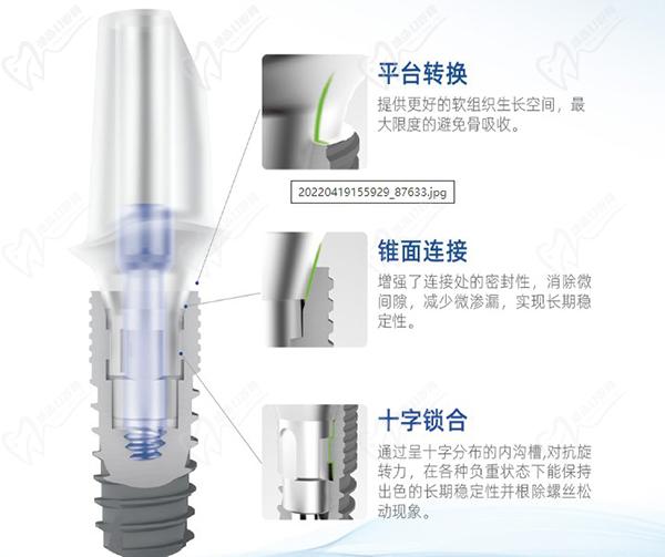 康盛種植牙型號