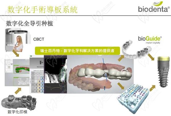 百丹特種植體型號及產品目錄