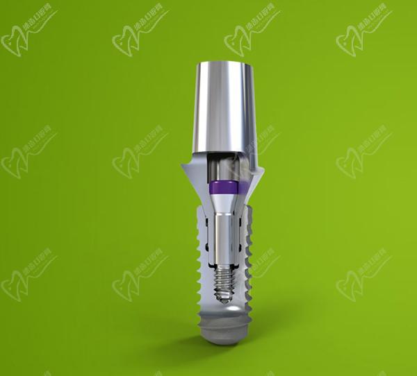 瑞士士卓曼種植牙的特點
