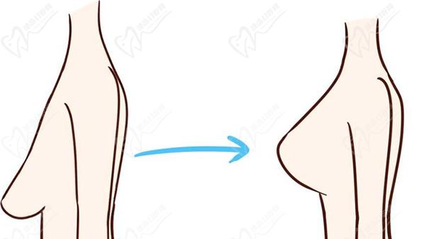 廣州唐志榮隆胸口碑怎么樣