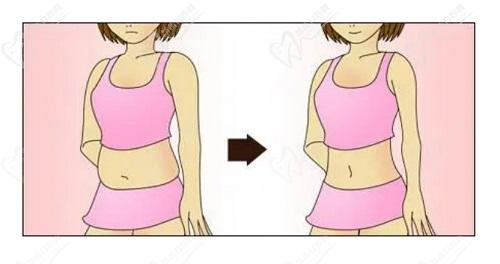 合肥壹加壹孟松抽脂