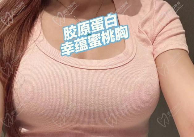 幸蘊(yùn)15分鐘無痕豐胸價(jià)格