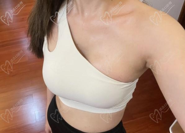 幸蘊(yùn)15分鐘無痕豐胸價(jià)格