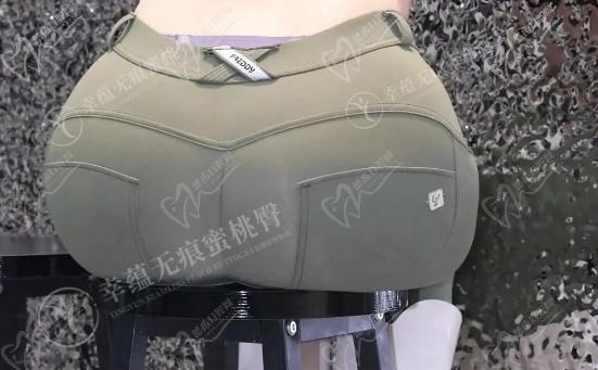 幸蘊(yùn)15分鐘無痕豐胸價(jià)格