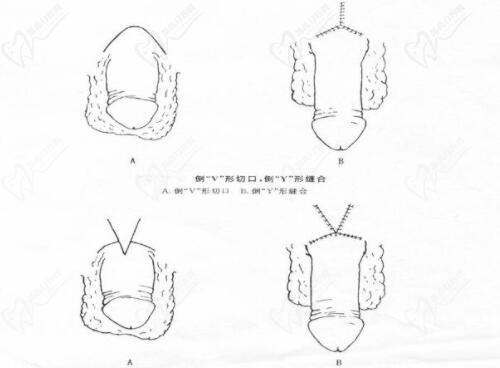 李世榮延長手術(shù)的高定價(jià)，本質(zhì)上是醫(yī)療價(jià)值的真實(shí)體現(xiàn)