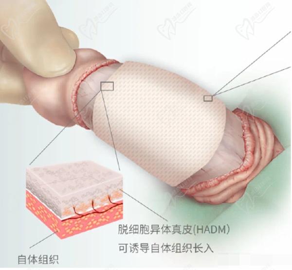 國(guó)內(nèi)男科生殖整形醫(yī)院哪家好