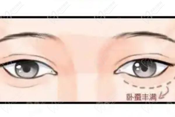 北京薛紅宇醫(yī)生做眼袋預(yù)約掛號(hào)