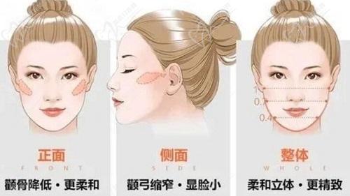重慶何才偉和安可忍醫(yī)生磨骨技術(shù)特點(diǎn)分析
