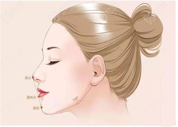 上海葉麗萍醫(yī)生做鼻基底手術(shù)嗎？