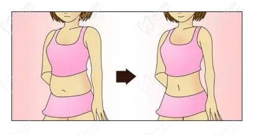 合肥壹加壹孟松抽脂量大平整，5a規(guī)范腰腹吸脂7000起技術(shù)給力