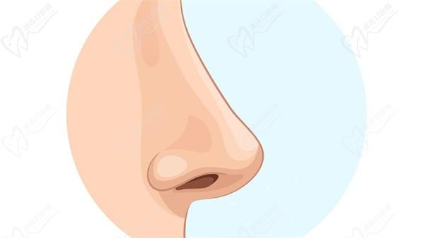 上海葉麗萍醫(yī)生做鼻基底手術(shù)嗎？華美美鼻技術(shù)派親診 自然風改善鼻凹有一手